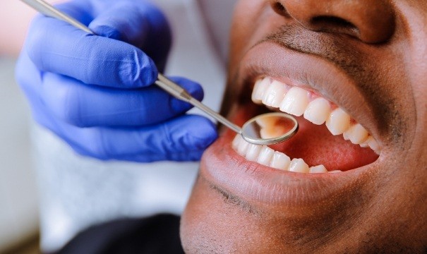 Dentist examining patients smile after full mouth rehabilitation
