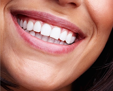 Close up of woman with flawless straight white teeth