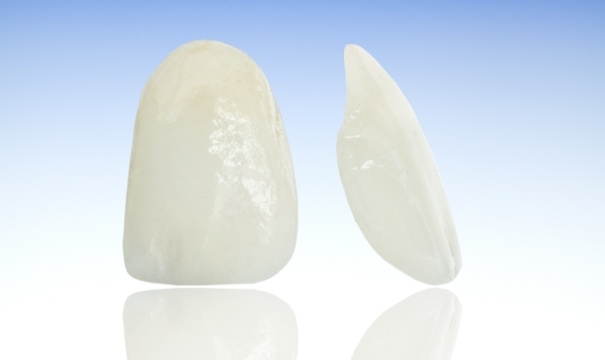 Metal free dental restoration sample