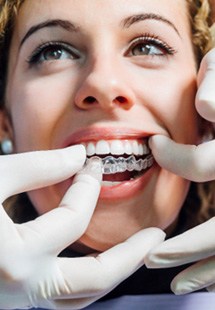 patient getting Invisalign from dentist 
