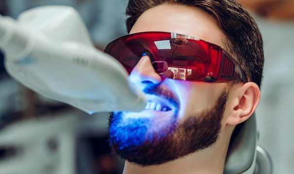 Smile makeovers vary in price depending on the individual patient