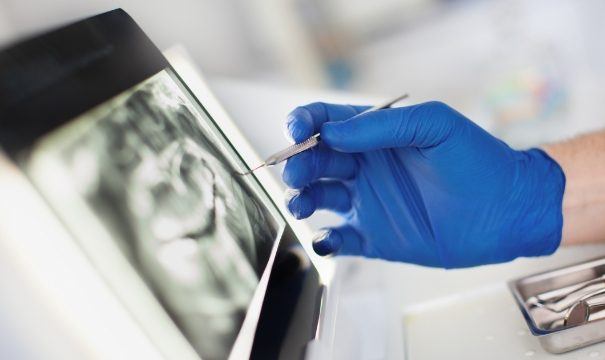 Dentist examining digital x-rays