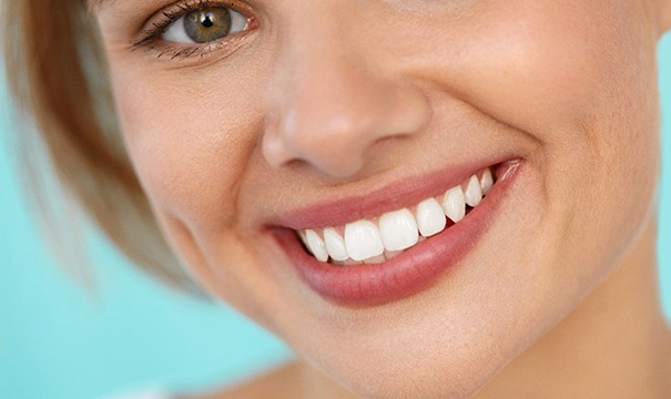 close up of young woman smiling after getting veneers in Boston 