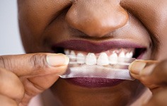 Woman using whitening strips