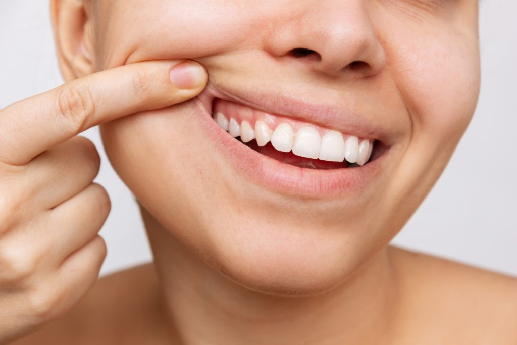 Smiling patient showing her healthy gums