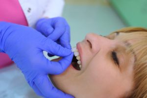 a woman getting veneers from her dentist